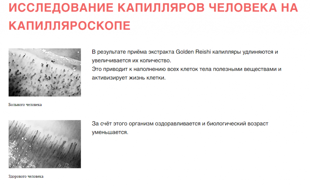 капилляры